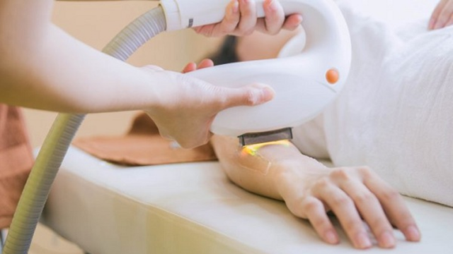 Công nghệ triệt lông IPL