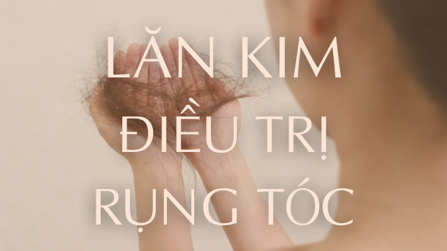 Điều trị rụng tóc